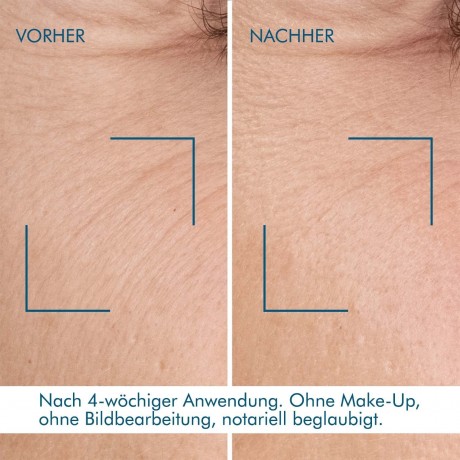 Biotherm Blue Retinol Resurface + Repair Night Serum  Blue Retinol Resurface + Восстанавливающая ночная сыворотка