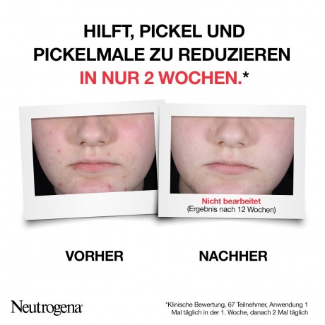 Neutrogena AHA/PHA/BHA Serum  Сыворотка AHA/PHA/BHA