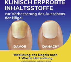 SCHOLL Nagel Revitalisierer, 10 ml, Шолль Восстановитель ногтей, укрепление и блеск, 10 мл