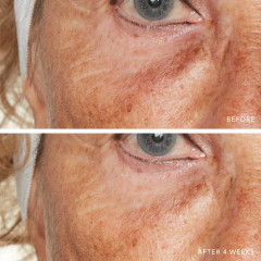 Lancer Advanced C Radiance Cream  Усовершенствованный крем для сияния кожи C