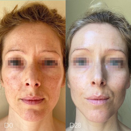 Caudalie Serum сыворотка