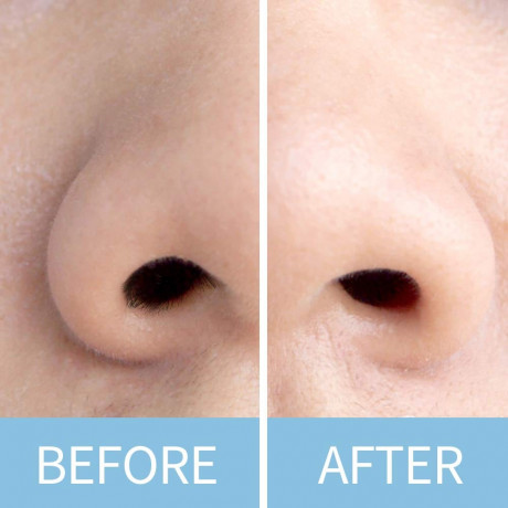 UNIQ Nasenwachs-Sticks  Восковые палочки для носа